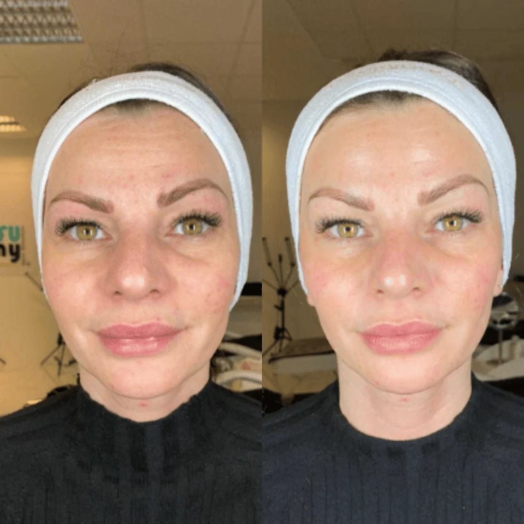 Mascara de Colageno Facial Nocturna Premium - Goldenfy Chile