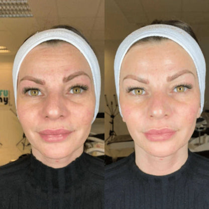 Mascara de Colageno Facial Nocturna Premium - Goldenfy Chile